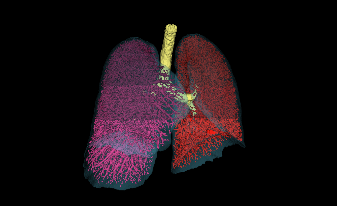 Map of blood vessels contained within the lungs.